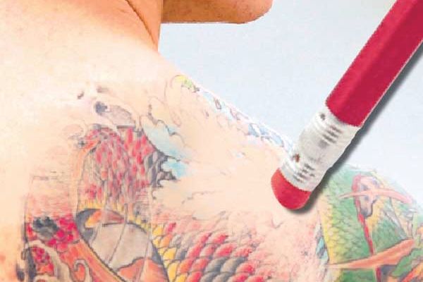 Erase Your Past With Tattoo Removal Cream | Gephardt Daily