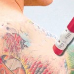 Erase Your Past With Tattoo Removal Cream