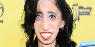 Lizzie Velasquez