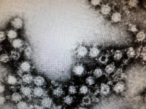 Enterovirus 68 - Photo Courtesy: Centers for Disease Control