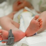 Umbilical Cord “Milking” Improves Blood Flow in Preterm Infants 