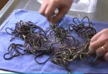 62 Hairbands and 8 Undies inside Dog's Stomach