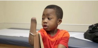 Zion Harvey before First Bilateral Hand Transplant