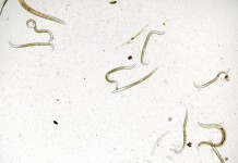 Nematode Worms Affected by Starvation