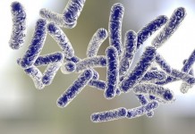 Legionnaires  Water Born Bacteria