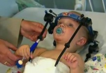 Baby's Head Reattached