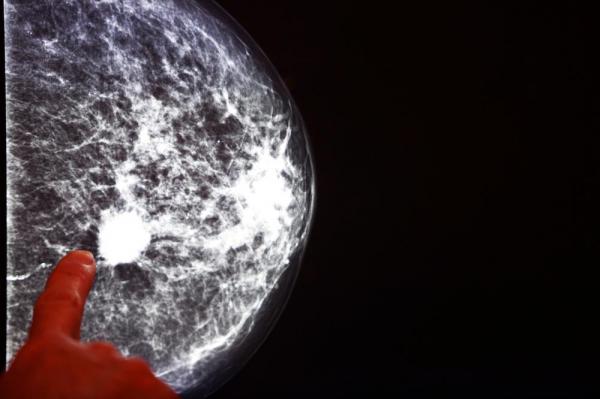 Optical-scanner-could-allow-real-time-breast-cancer-screening