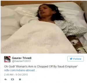 saudi woman arm cut off