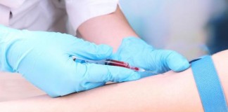 Blood Test May Predict Post-Surgery Recovery Time