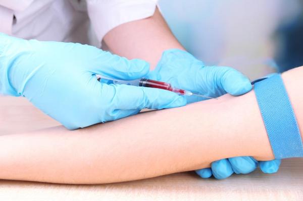 Blood Test May Predict Post-Surgery Recovery Time