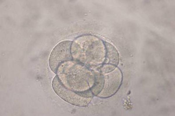 Divorced Couple's Embryos Must Be Destroyed