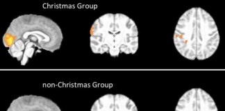 MRI Scans Reveal Christmas Spirit