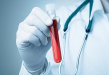 Ovarian Cancer Blood Test