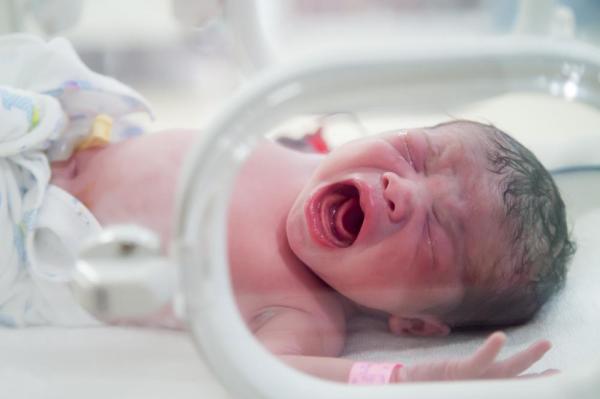 Babies Born With Organs Outside Their Bodies