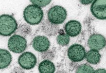Colorized micrograph showing many green spherical cells or particles scattered on a gray background.